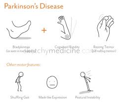 Pengobatan Parkinson Secara Tradisional